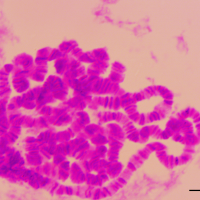 Cromosoma gigante glandula salival 100x  z0.8